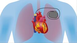 Benefits of Technology Instructional Video