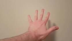 Abduction vs. Adduction of the Fingers, Clinical Tests and an Easy Way to Remember Instructional Video