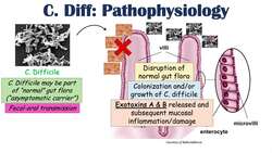 Clostridium Difficile (Antibiotic-Associated Diarrhea) Risk Factors, Symptoms, Diagnosis, Treatment Instructional Video
