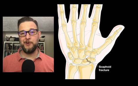 Bones of the hand