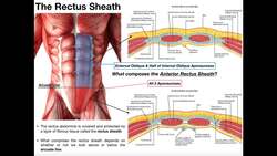 Anatomy of the Rectus Sheath Instructional Video