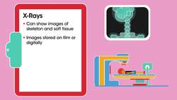 Medical Imaging Instructional Video