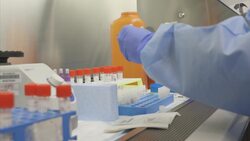 NY looks to private labs to boost virus testing News Clip