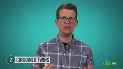Beyond Identical or Fraternal: 6 Rare Types of Twins Instructional Video