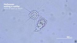 Heliozoa: Round, Sticky, and Covered in Spikes Instructional Video