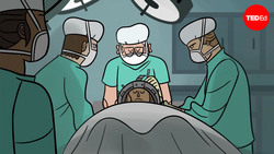 TED-Ed: Can you transplant a head to another body? | Max G. Levy Instructional Video