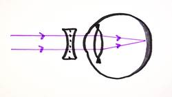 Correcting Vision _ GCSE Physics Instructional Video