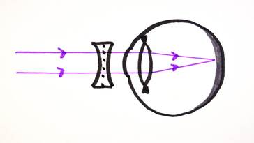 Correcting Vision _ GCSE Physics