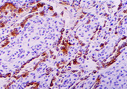 Antigen Instructional Video