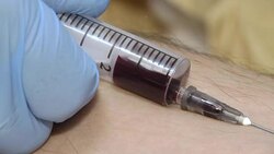 Blood collection, Nurse taking blood sample for analysis. Nurse taking a blood sample for medical examinations. The doctor or nurse will take a blood sample from a vein for testing. Stock Footage