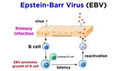 Mononucleosis (Epstein-Barr Virus) Instructional Video