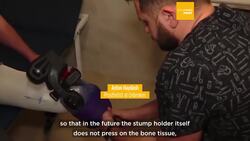 The small prosthetic workshop helping war-wounded Ukrainians rebuild their lives News Clip