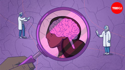 TED-Ed: Why is Alzheimer’s disease so difficult to treat? | Krishna Sudhir Instructional Video