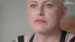 Scars Instructional Video