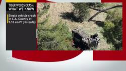 Tiger Woods 'awake, responsive' after surgery following car crash News Clip