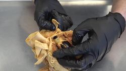 Understanding Broken Heart Syndrome: Causes, Symptoms, and Prognosis Instructional Video