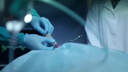 Surgeon hands pouring blood in syringe at surgical procedure. Medical operation Stock Footage
