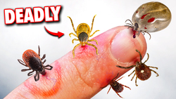 5 Deadly Tick Bites you Need To Worry About! Instructional Video