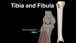 Tibia and Fibula Instructional Video