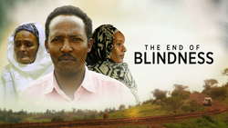 Battling Cataracts From Washtington to Ethiopia Instructional Video