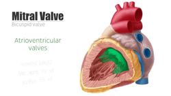 Mitral valve Instructional Video