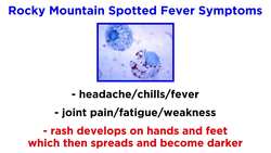 Rocky Mountain Spotted Fever Rickettsia rickettsii Instructional Video