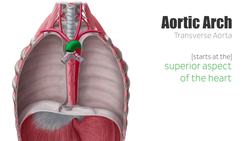 Aortic arch Instructional Video