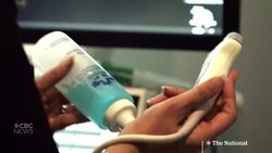 Women, cancer doctors raise alarm over shortage of breast ultrasound clinics News Clip