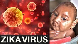The Zika Outbreak Explained Instructional Video