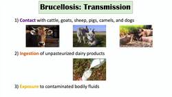 Brucellosis (Mediterranean Fever) | Transmission, Pathogenesis, Symptoms, Diagnosis, Treatment Instructional Video