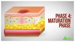 Why Smoking Makes It Harder to Heal Instructional Video