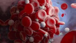 Do Wounds Heal Faster Covered Or Uncovered? Instructional Video