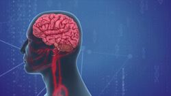 Wearing a tie could be detrimental to your health Instructional Video