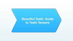 What Are Teeth Veneers? Instructional Video