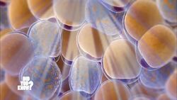 Confronting Cellulite and Stretch Marks: Scientific Advances and Treatments Instructional Video