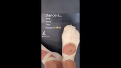 Ballet Problems!!  #shorts Instructional Video