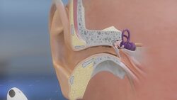 Scientists explain why wireless earphones cause wax overload Instructional Video