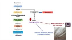 Albinism | Genetics, Different Types, and What You Need to Know Instructional Video