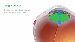 Linse und Corpus ciliare Instructional Video