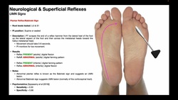 Plantar Reflex & the Babinski Sign EXPLAINED Instructional Video