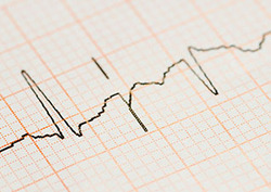 Accuracy Instructional Video