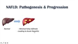 Non-Alcoholic Fatty Liver Disease, Risk Factors, Symptoms (ex. Fatigue), Treatment (ex. Coffee) Instructional Video