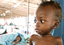 Malnutrition Instructional Video