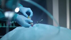 Surgical hands pouring blood in syringe in surgeon room. Surgical operation Stock Footage