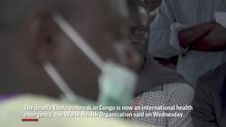 Congo Ebola outbreak, a global health emergency Instructional Video