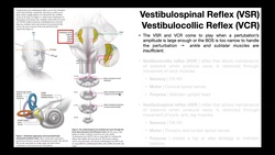 RPAs EXPLAINED [Part 2a] | Vestibulospinal Reflex (VSR) & Vestibulocollic Reflex (VCR) Instructional Video