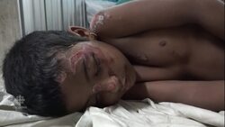 Rohingya girl in Bangladesh hospital News Clip