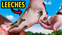 Attacked by Bloodsucking Parasites! Instructional Video