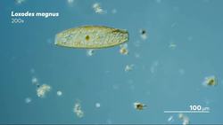 This Ciliate Is About to Die Instructional Video