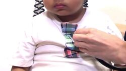 Whooping cough is surging in N.L. Here are the symptoms News Clip